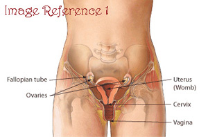 Diagram of fallopian tubes and how it applies to PID