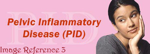 Pelvic Inflammatory Disease Support